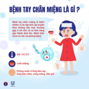 CẢNH GIÁC VỚI BỆNH TAY CHÂN MIỆNG Ở TRẺ EM